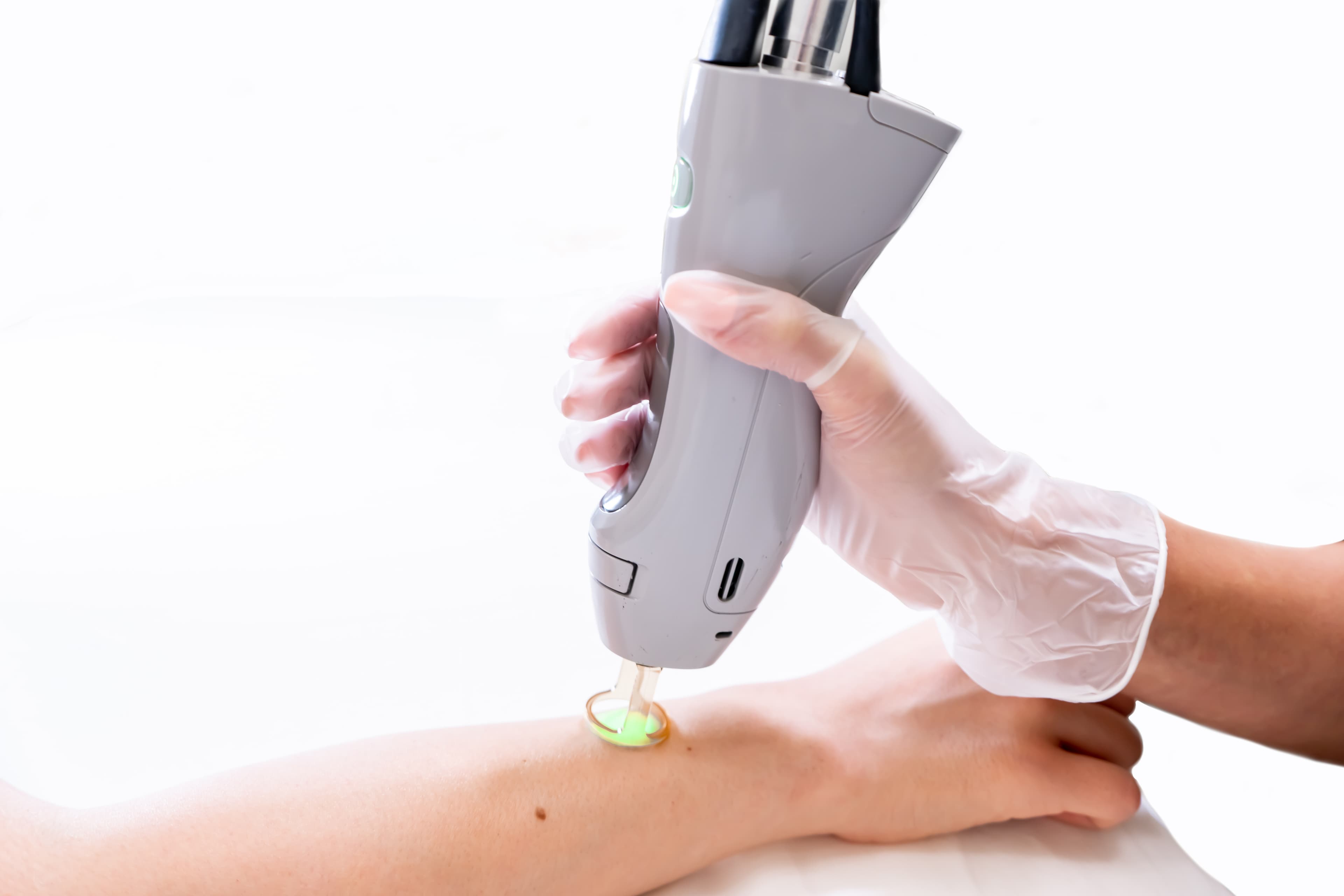 Laser Hair Removal at German Clinic