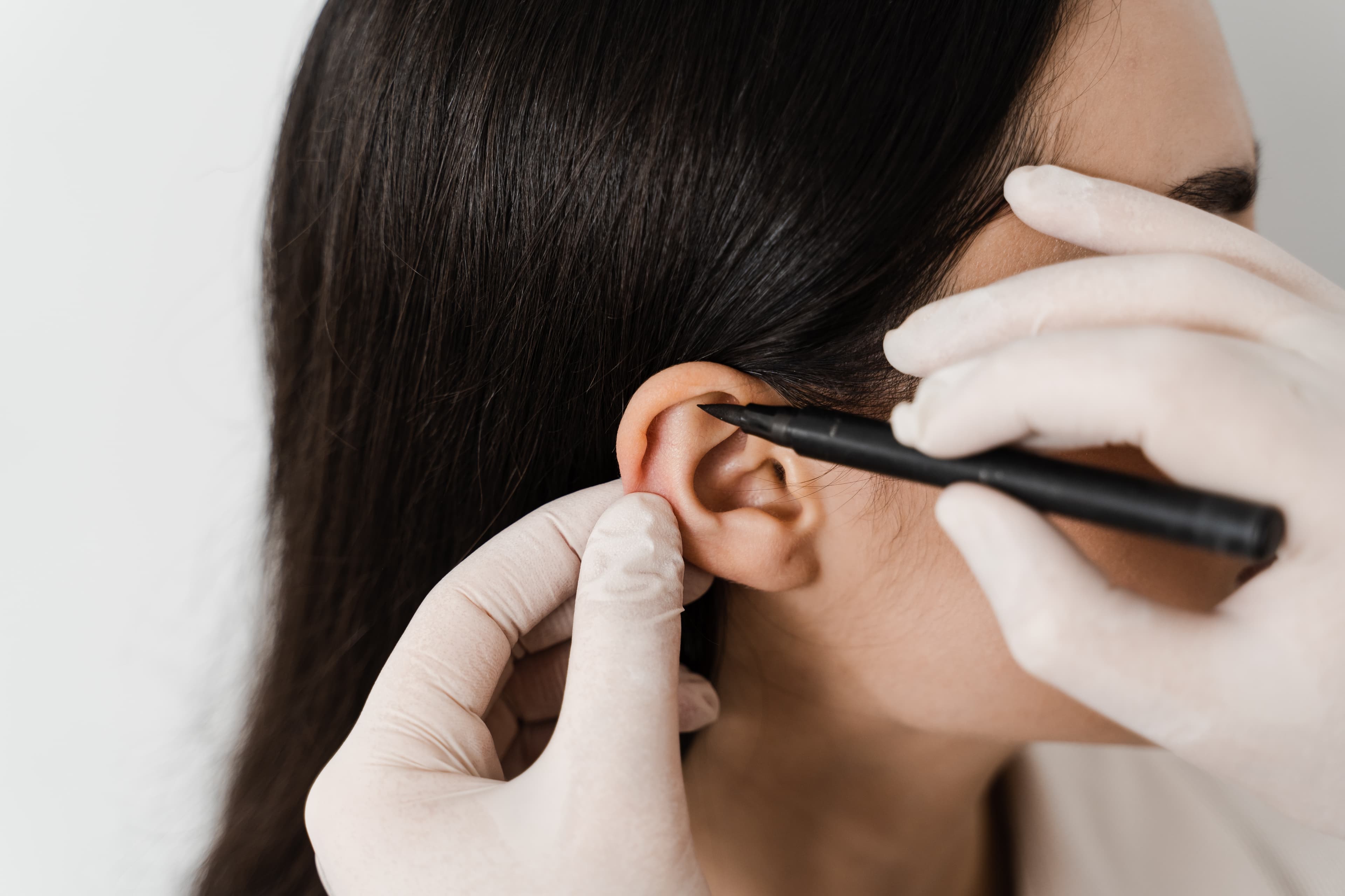 Ear Correction (Otoplasty) Ear Correction Planning